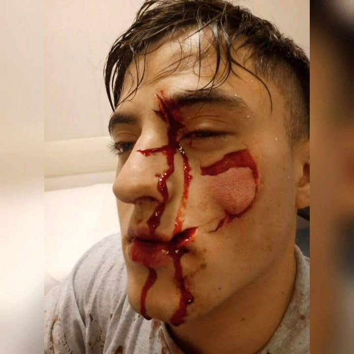 El audio de Santiago que mandó por WhatsApp tras el ataque