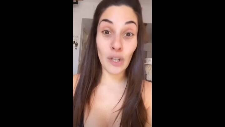 Ivana Nadal habló de cómo será su próxima operación de implantes