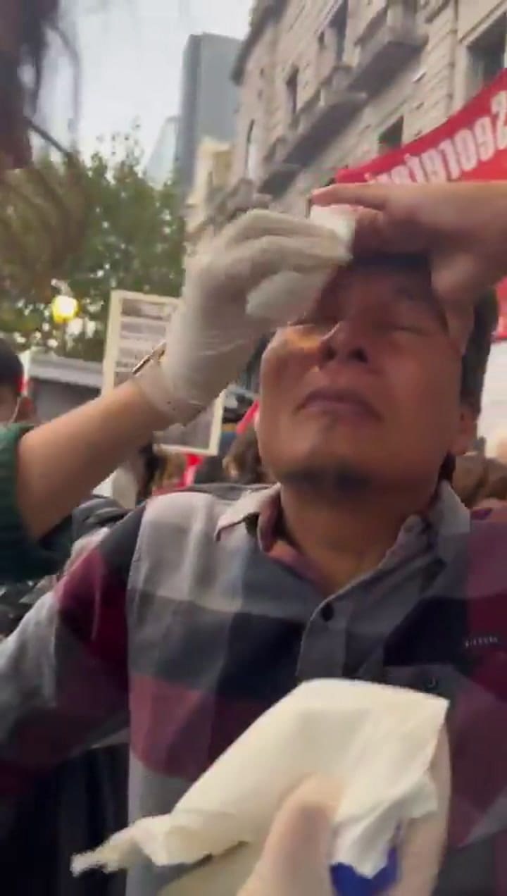 Un diputado denunció que fue gaseado durante la marcha de jubilados