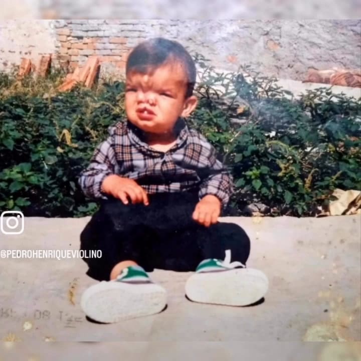 Un hombre nació con nariz bífida, pero una cirugía cambió su vida y se convirtió en violinista