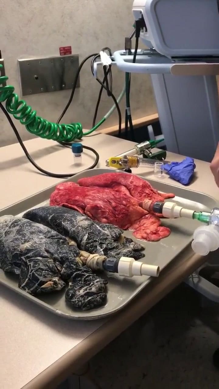 Así respiran unos pulmones sanos - Fuente: Facebook