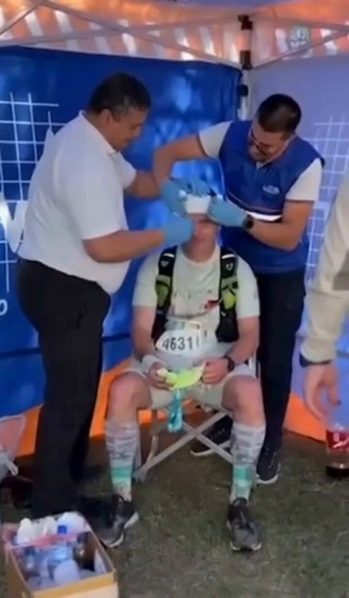 Córdoba: un maratonista alcanzó la línea de llegada, festejó cabeceando un cencerro y se abrió la cabeza