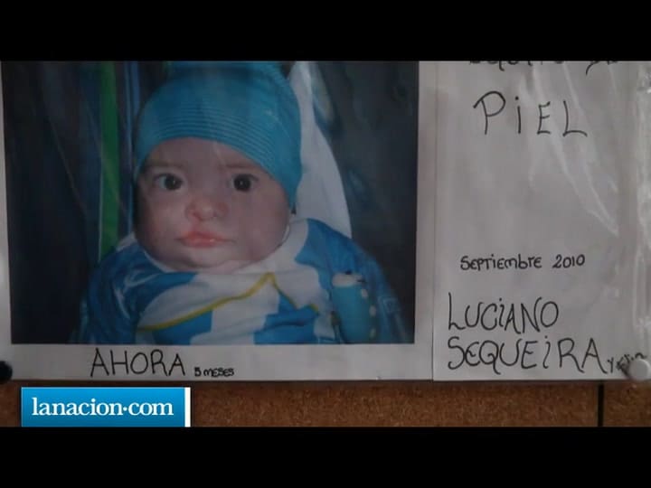 El shock de nacer con labio leporino