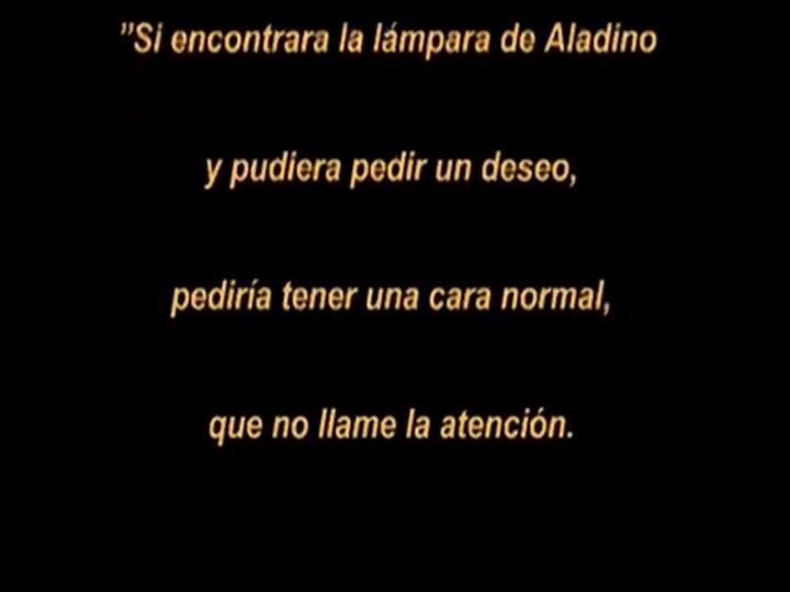 Cómo es vivir en la Argentina con el síndrome de Treacher Collins