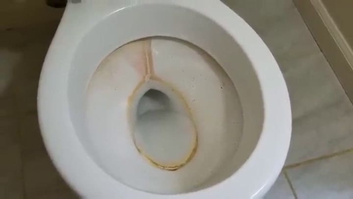 Como Limpiar El Inodoro Quitar El Sarro Y La Terrible Linea Amarilla Super Facil!!