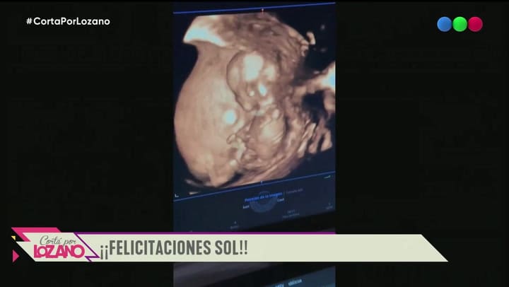 Sol Pérez está embarazada