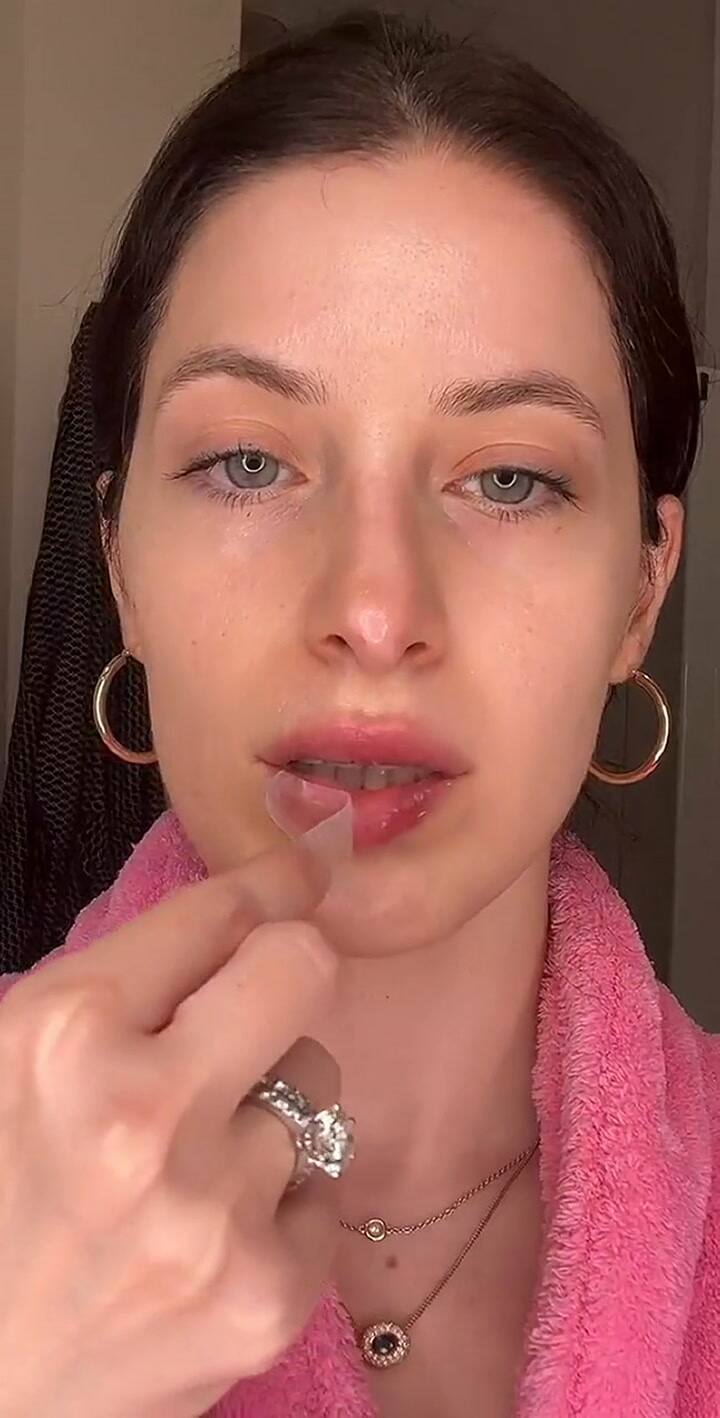 Una tiktoker quiso agrandarse los labios y esto ocurrió (parte II)