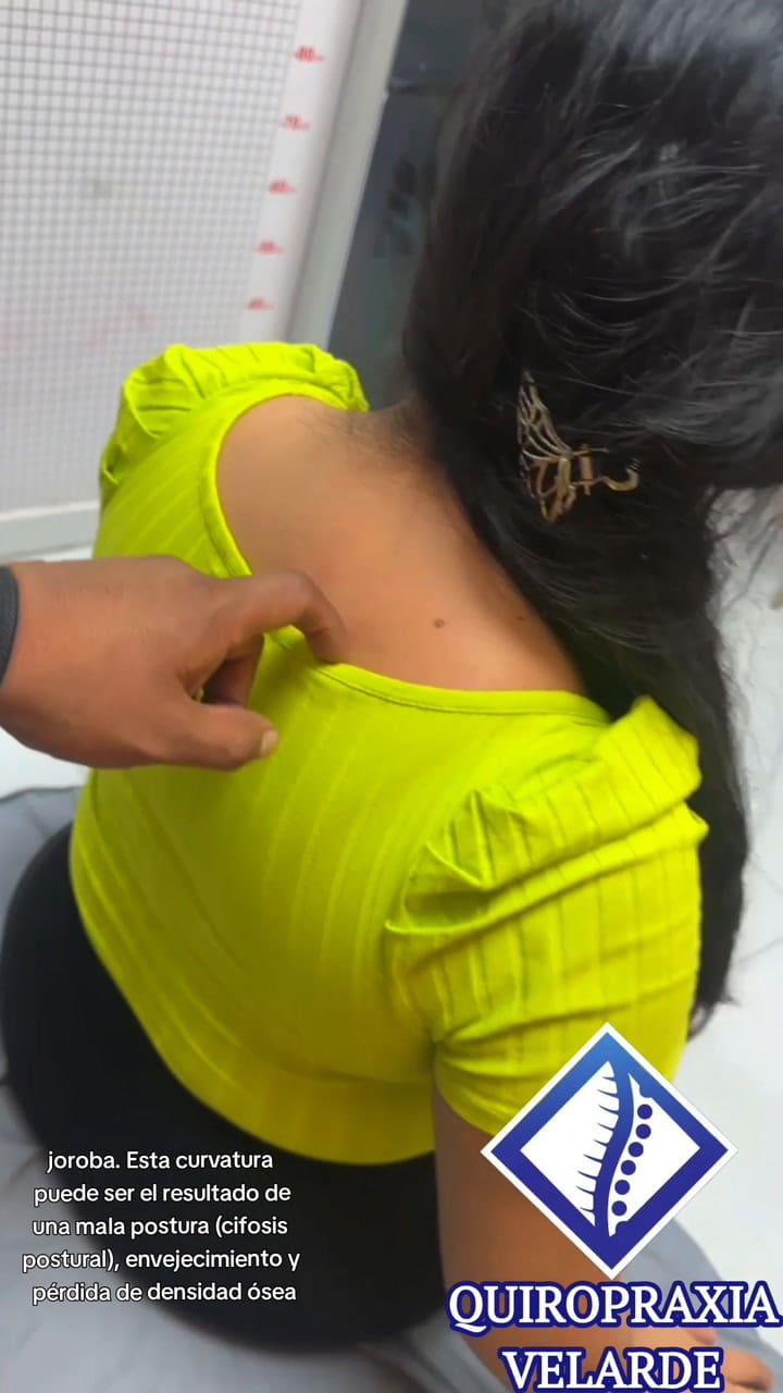 #Quiropraxia #Mejoratusaludhoy #Mejoratusalud #Lim #Tiktokkers #Tiktok Tok #Tiktoktraditons #Malapostura