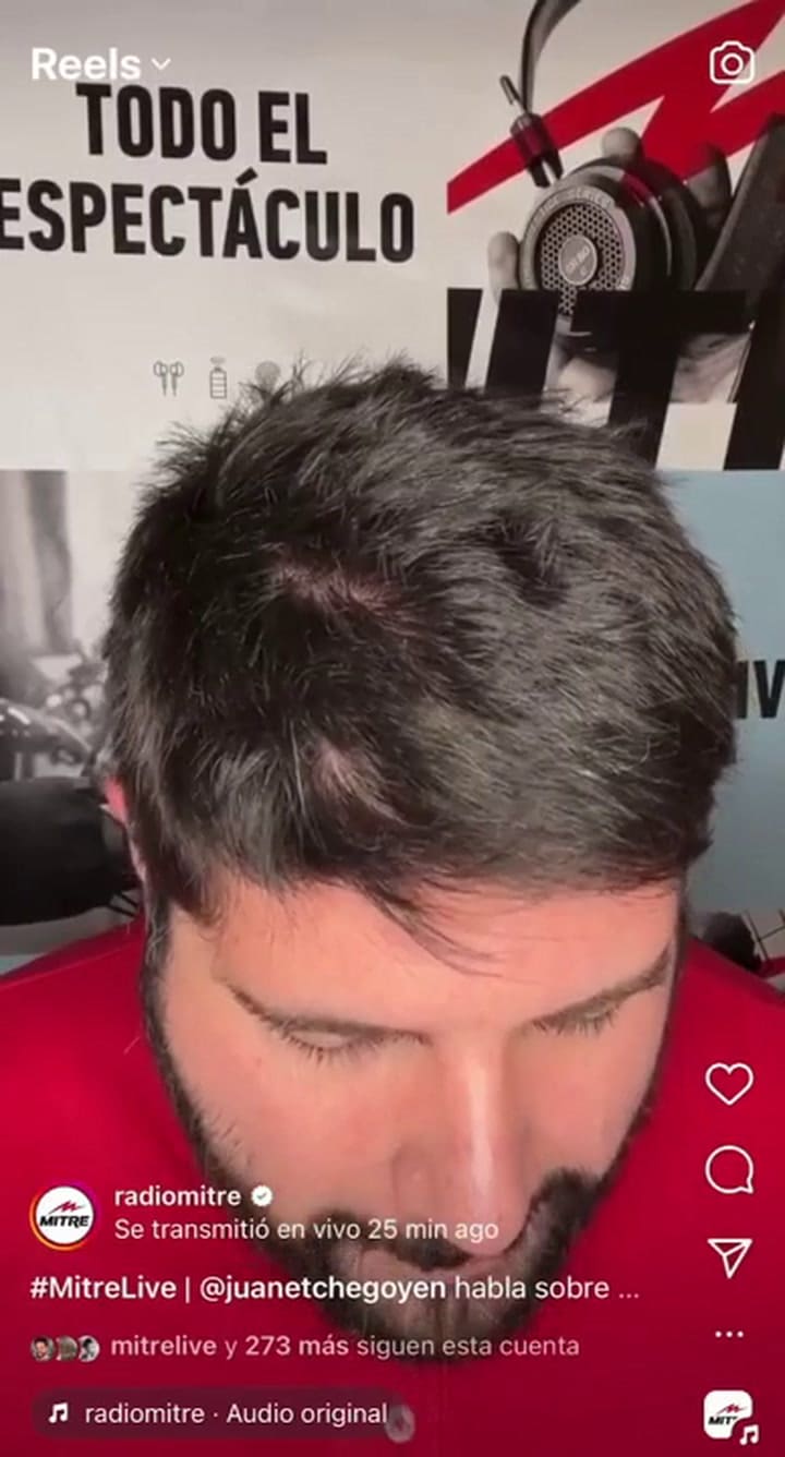 El periodista Juan Etchegoyen contó en Mitre Live cómo fue el accidente de L-Gante en Paraguay