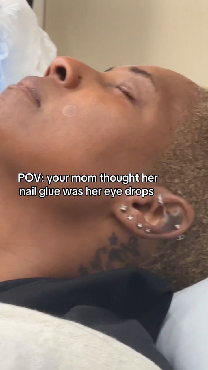 Confundió gotas con pegamento