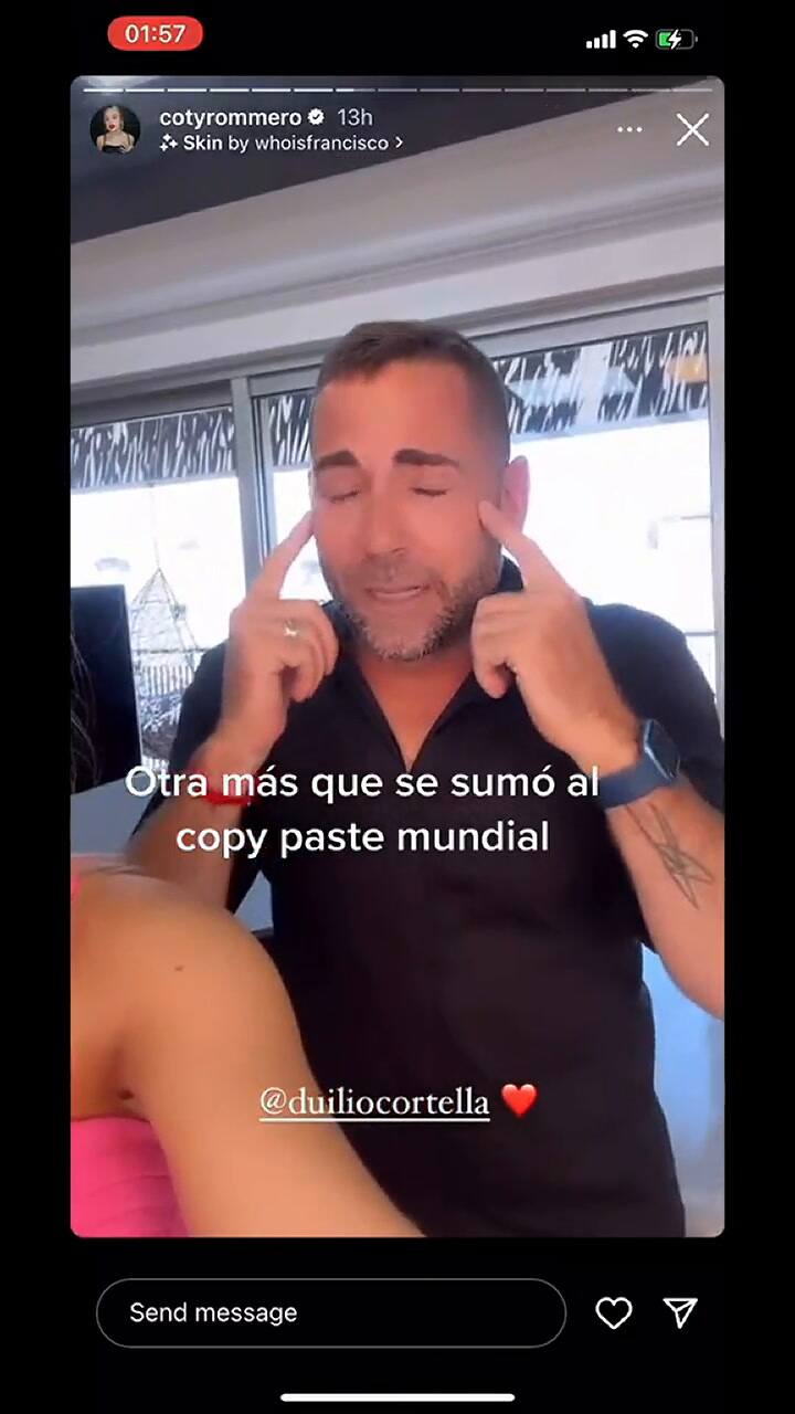 Coty Romero se aplicó un retoque estético y la fulminaron en las redes