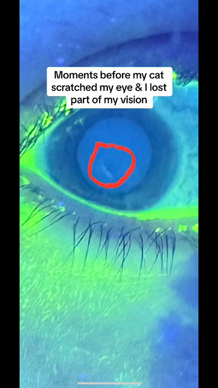 Se acercó a su gato y la lastimó con un arañazo