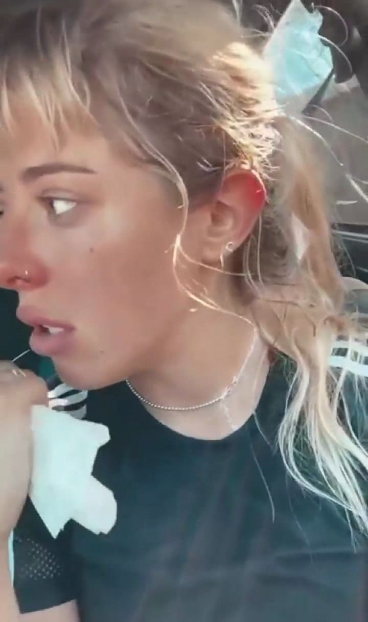 Nati Jota se accidentó jugando al paddle: 'Me puse mal en el momento porque me asusté'