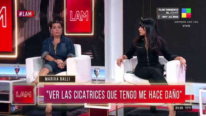 Marixa Balli habló de la mala praxis que sufrió
