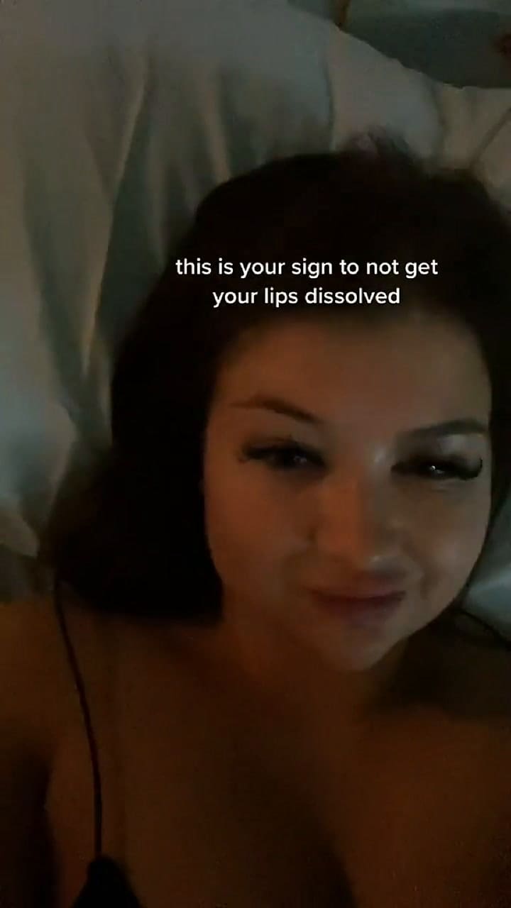 Así quedó una tiktoker después de un relleno de labios
