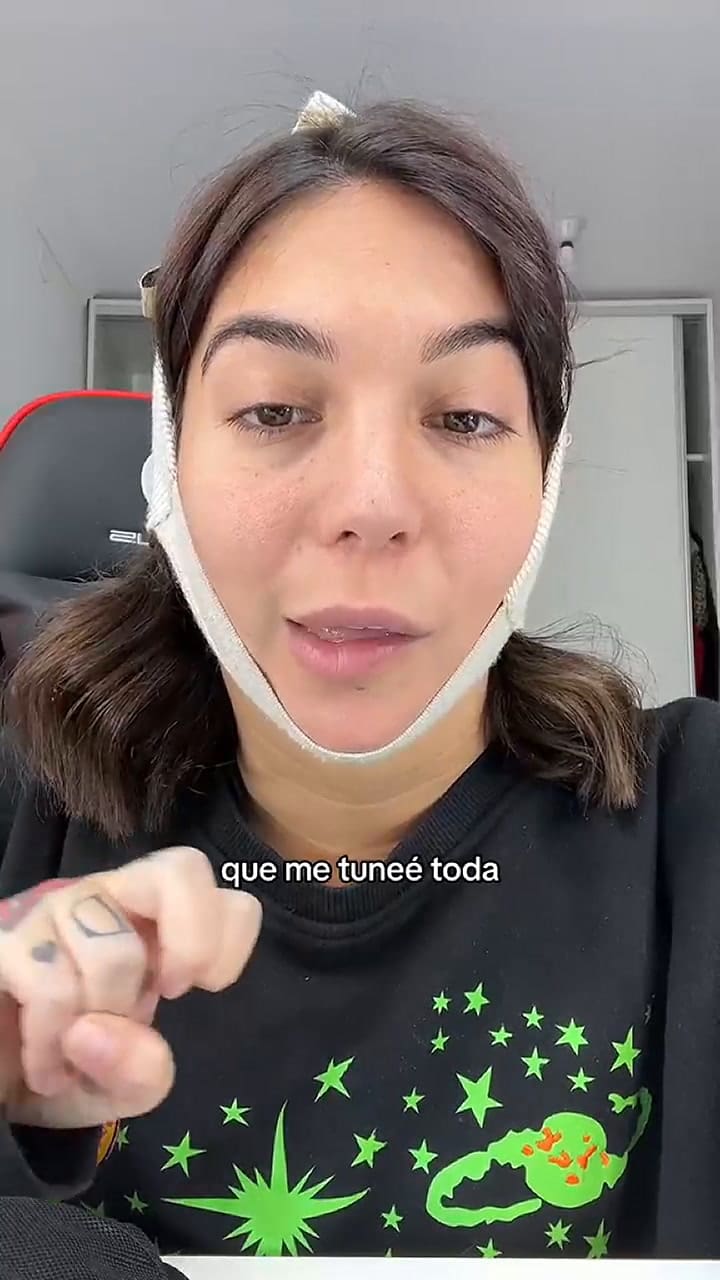 Una influencer mostró la consecuencia que tiene al someterse a una operación estética