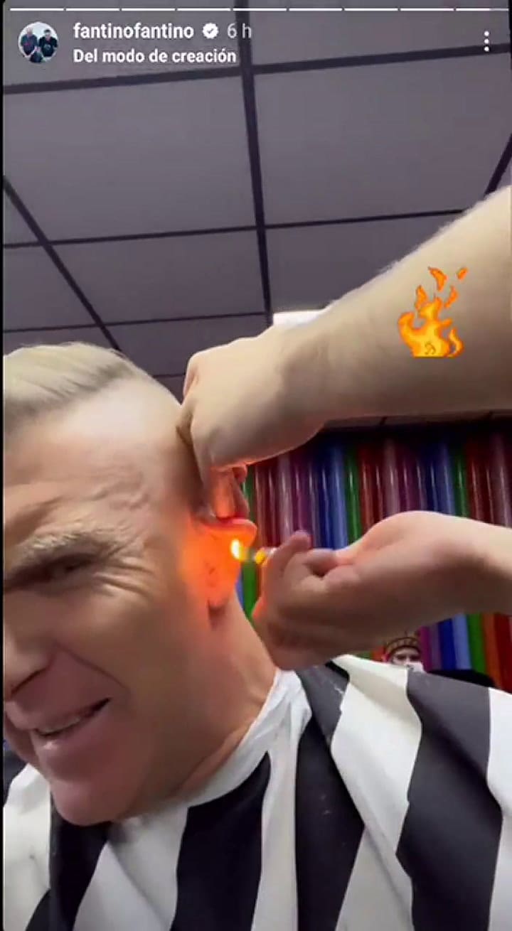 Alejandro Fantino sufrió la quemadura de su oreja mientras le cortaban el pelo en Estambul