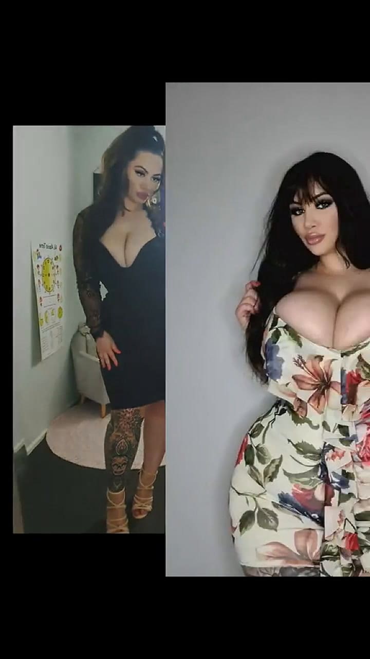 La extraña condición que sufre la mujer