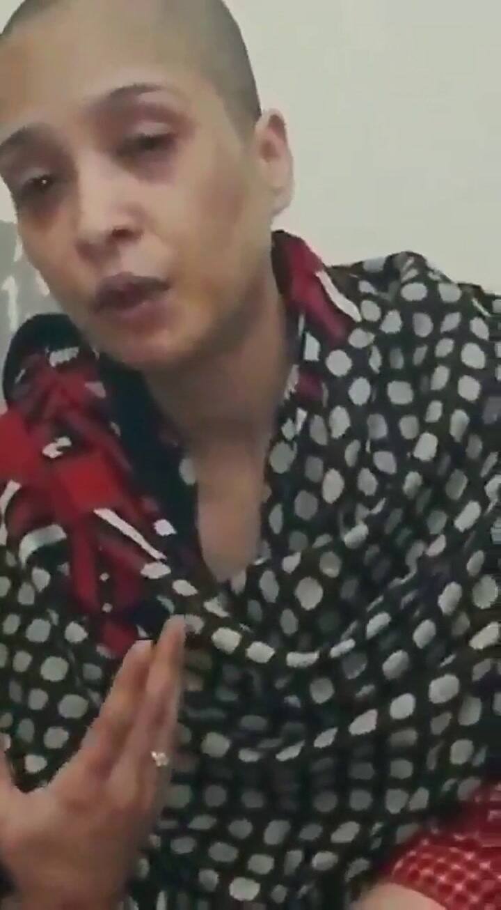 Asma Aziz mostró los golpes que sufrió por el maltrato de su esposo - Fuente: Twitter