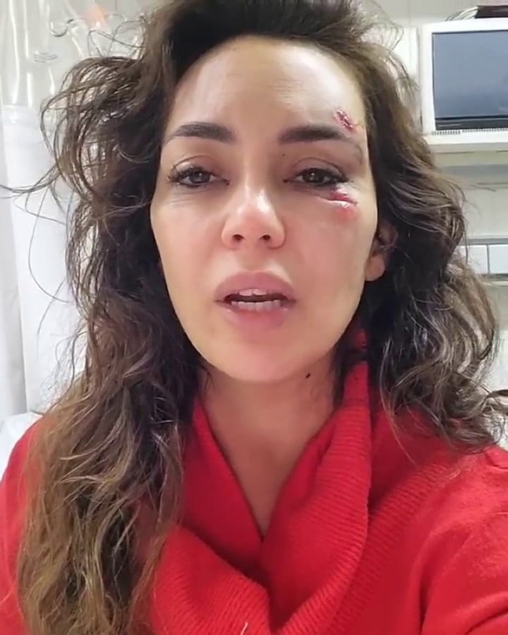 La novia de Guillermo Marín habló del accidente de moto que sufrieron