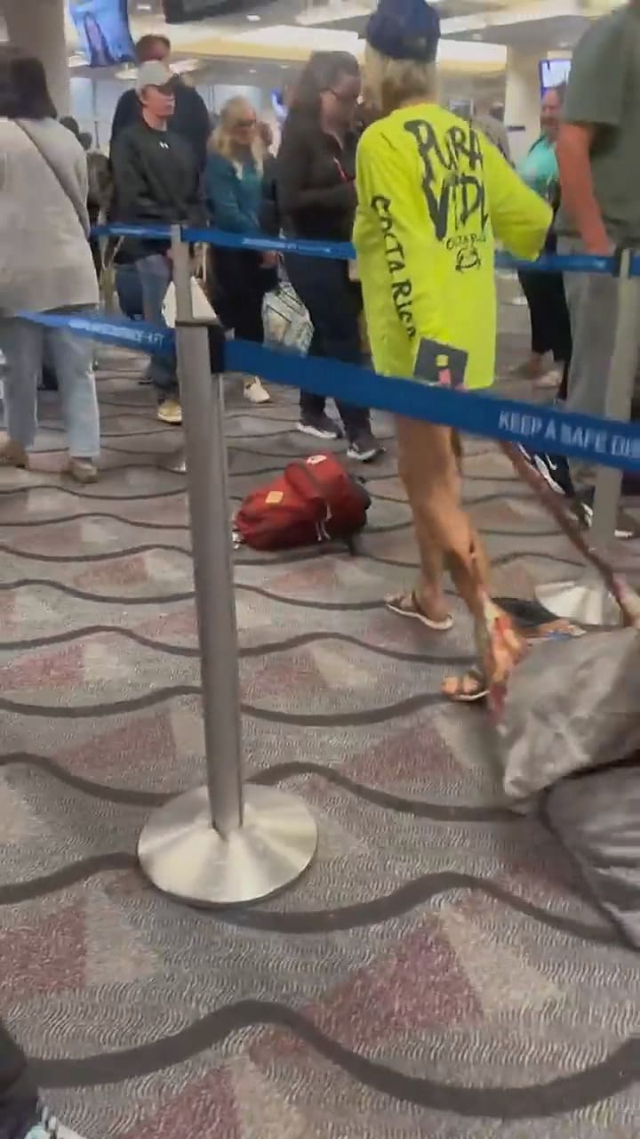 La mujer no vestía pantalones, solo una playera amarilla con las palabras Costa Rica