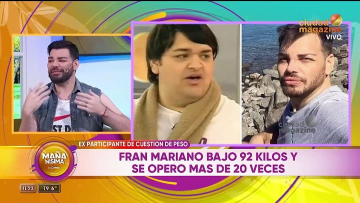 Fran Mariano se sometió a más de 20 cirugías que se hizo para parecerse a Ricky Martin