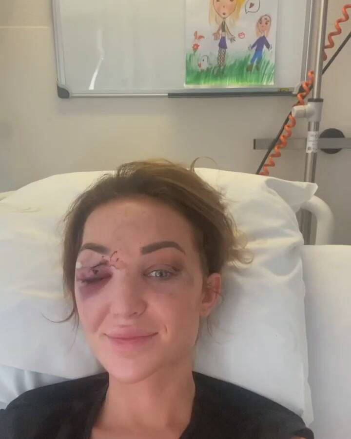 Chayenne van Aarle tuvo un peligroso accidente