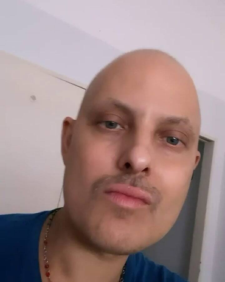 Lío Pecoraro mostró que su pelo comenzó a crecer en plena recuperación de la leucemia