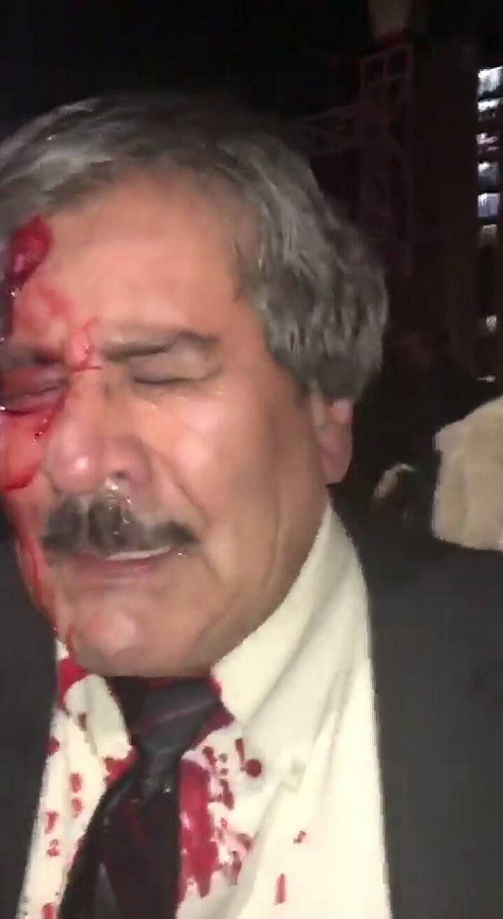 Waldo Albarracín, opositor boliviano, fue brutalmente agredido - Fuente: Twitter