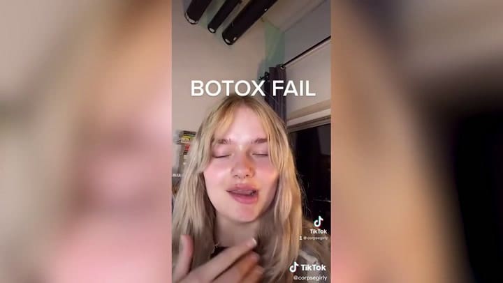 Sufrió una mala praxis en la aplicación de bótox y mostró los terribles resultados en el rostro