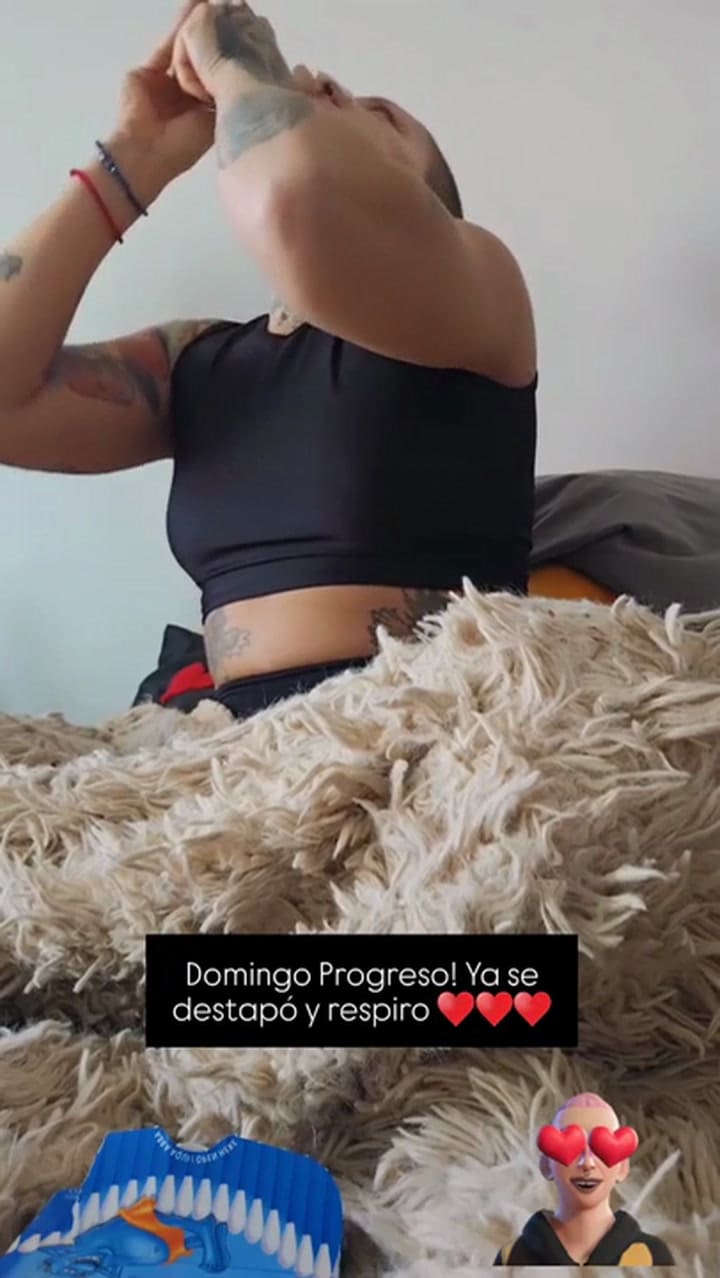 Furia Scaglione mostró cómo se recupera de su cirugía estética de nariz: “Progreso”