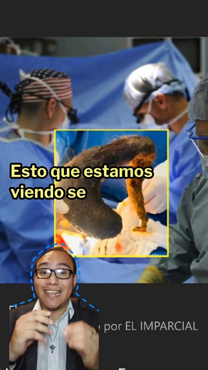 Experto explica el síndrome de Rapunzel