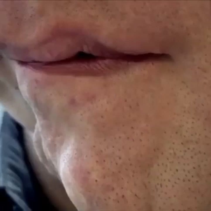 Adam Pearson habla de su historia de vida