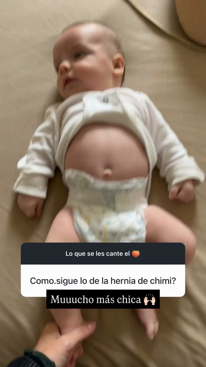 Juana Repetto contó cómo evoluciona su hijo tras la operación a la que fue sometido