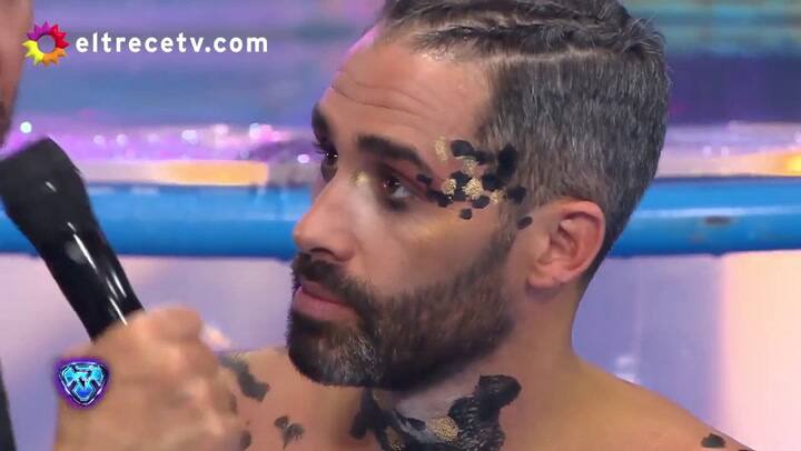 ShowMatch 2018: El Pollo Álvarez mostró el terrible golpe que sufrió - Fuente: YouTube