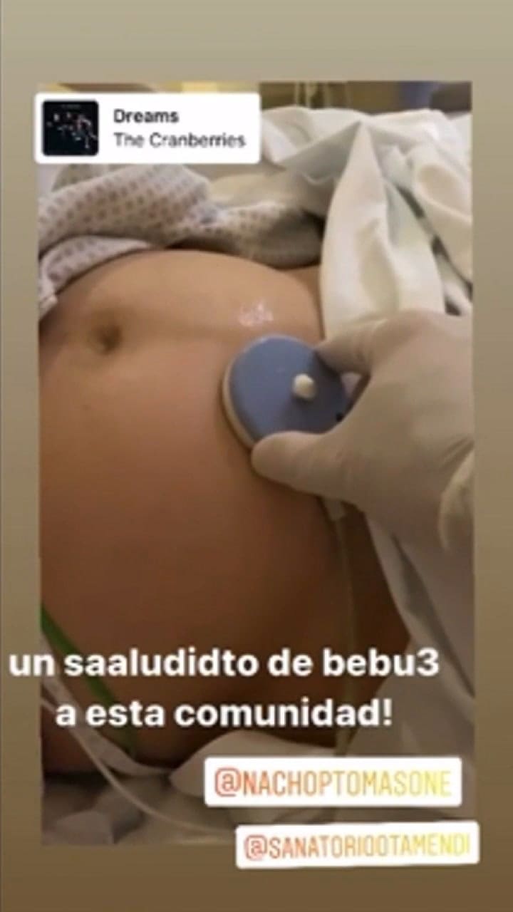 El momento en que a Karina Gao le hacían un monitoreo para saber cómo se encuentra su bebé