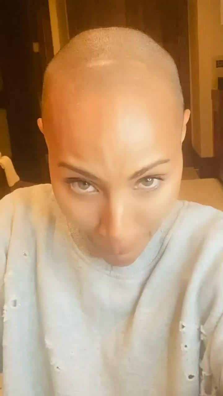 Jada Pinkett Smith habló sobre su alopecia