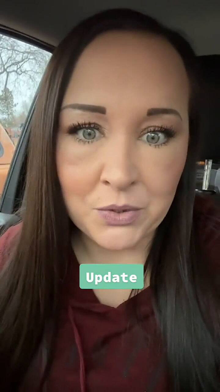 Una mujer tuvo una reacción alérgica al pintarse el cabello