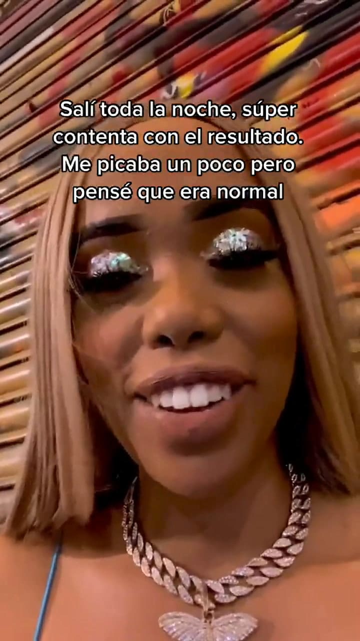 Joven solo quería ser la sensación de la fiesta y por poco pierde la visión