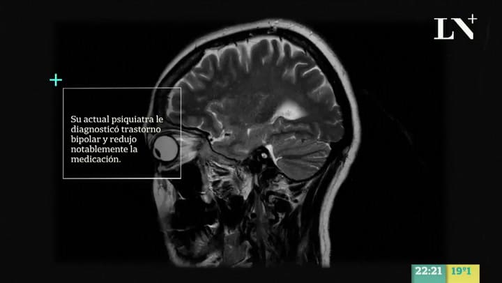 Le diagnosticaron depresión y estuvo mal medicada por diez años