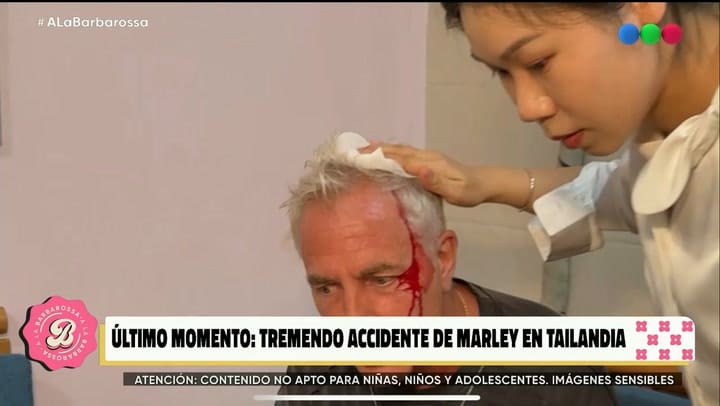 Marley contó cómo fue el accidente que sufrió en plena grabación