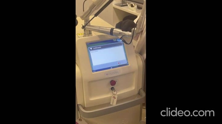 Candelaria Tinelli decidió borrarse un tatuaje y mostró el resultado en las redes sociales