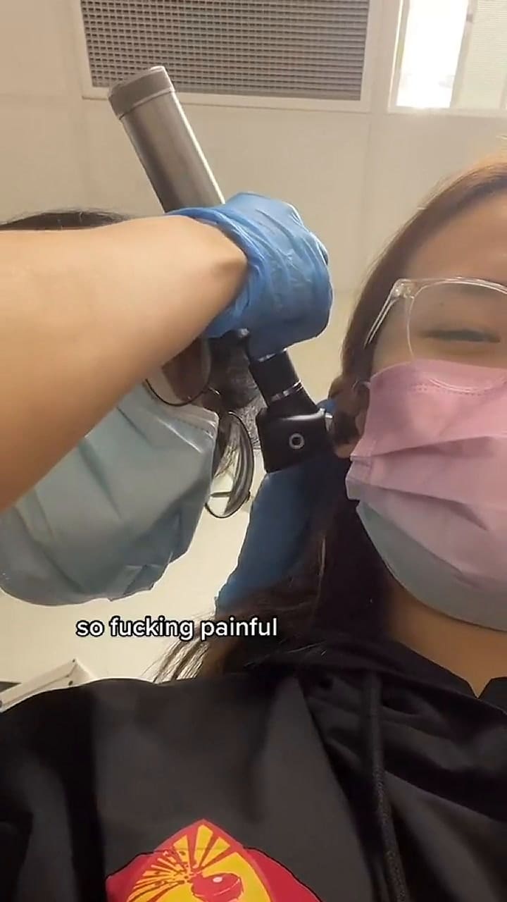 Terminó internada tras usar enjuague bucal para ahogar cucaracha