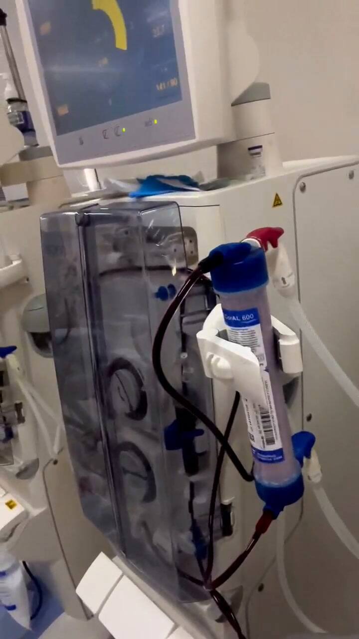 El video que compartió Silvina Luna mientras se realizaba diálisis