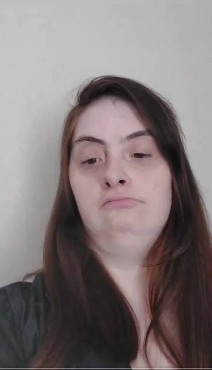 La Asociación de Sindrome de Down de la Argentina repudió los dichos de Milei y le exigió disculpas públicas