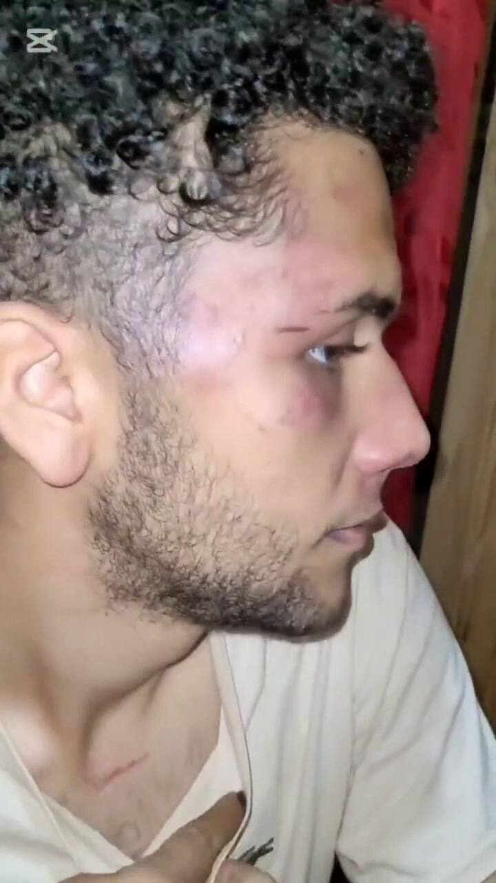 Jonás subió un video, junto a su madre, contando lo sucedido