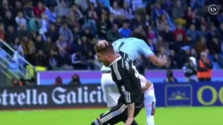 Cuando cabecear se convierte en un dolor de cabeza