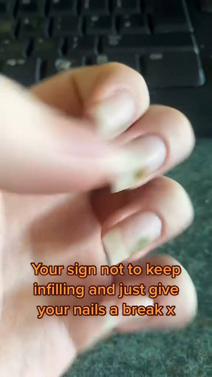 Una mujer quedó atónica cuando se percató de que sus uñas tenían moho después de un tratamiento