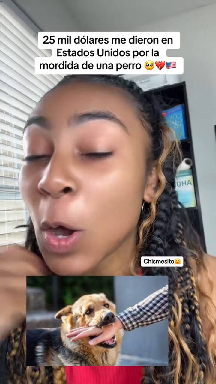 Un tiktoker contó la historia de una mujer que recibió 25.000 dólares tras ser mordida por un perro