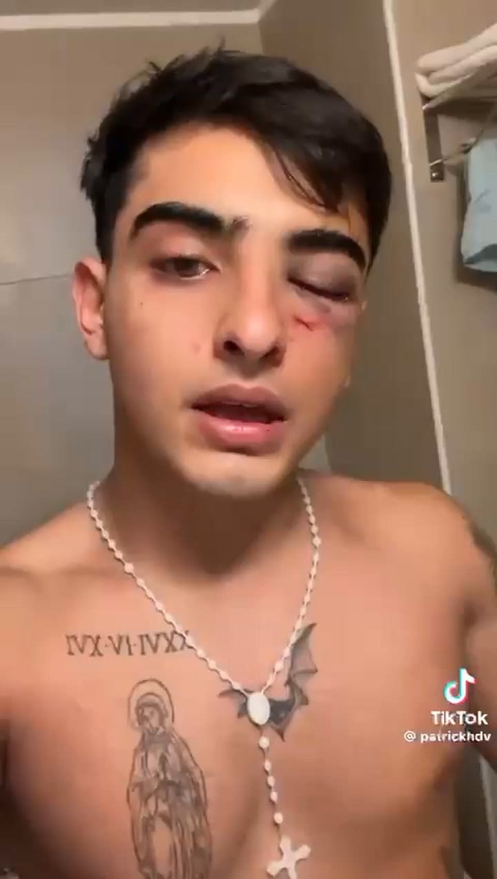 El mensaje del joven golpeado